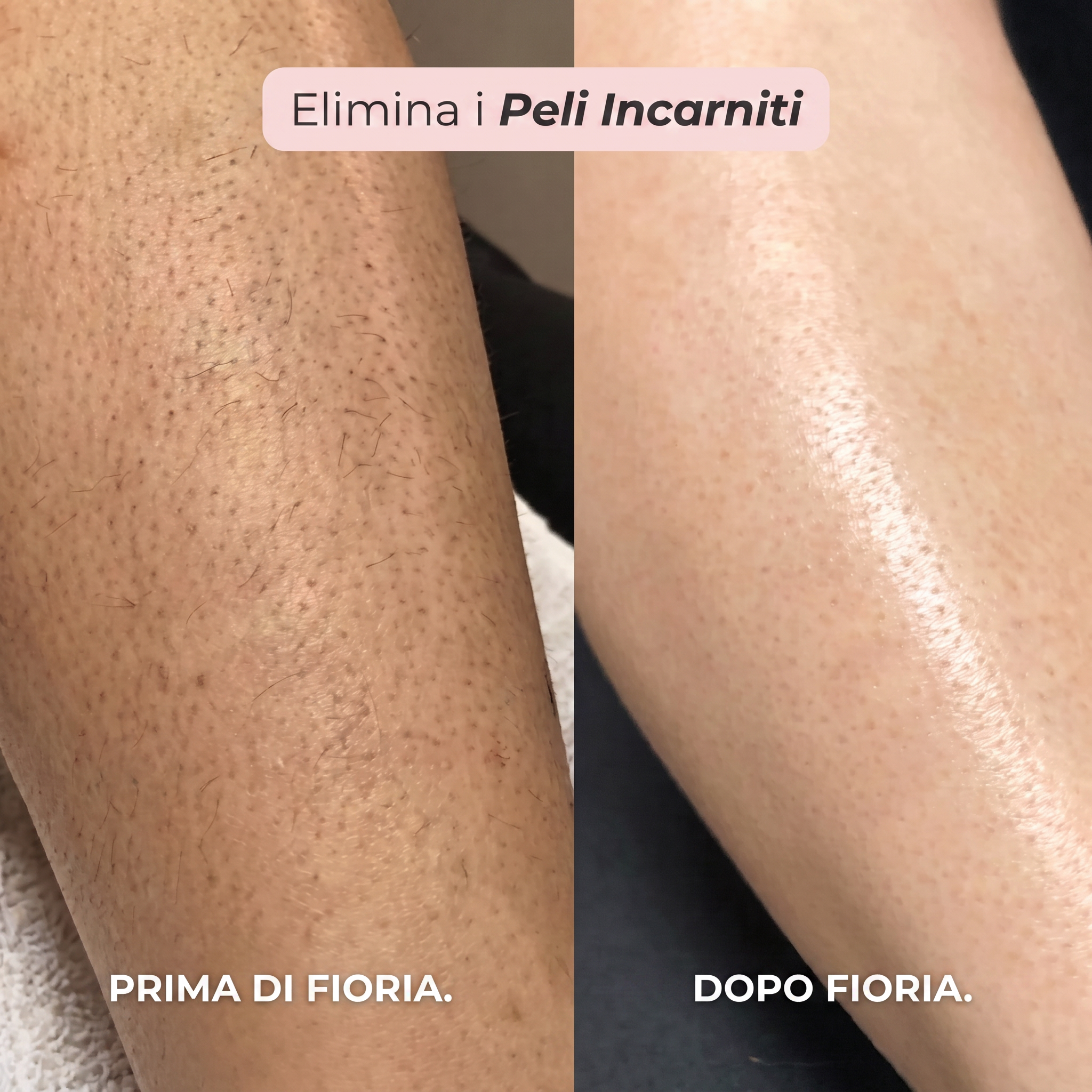 Rasoio 2 in 1 per Bikini e Corpo Fioria™
