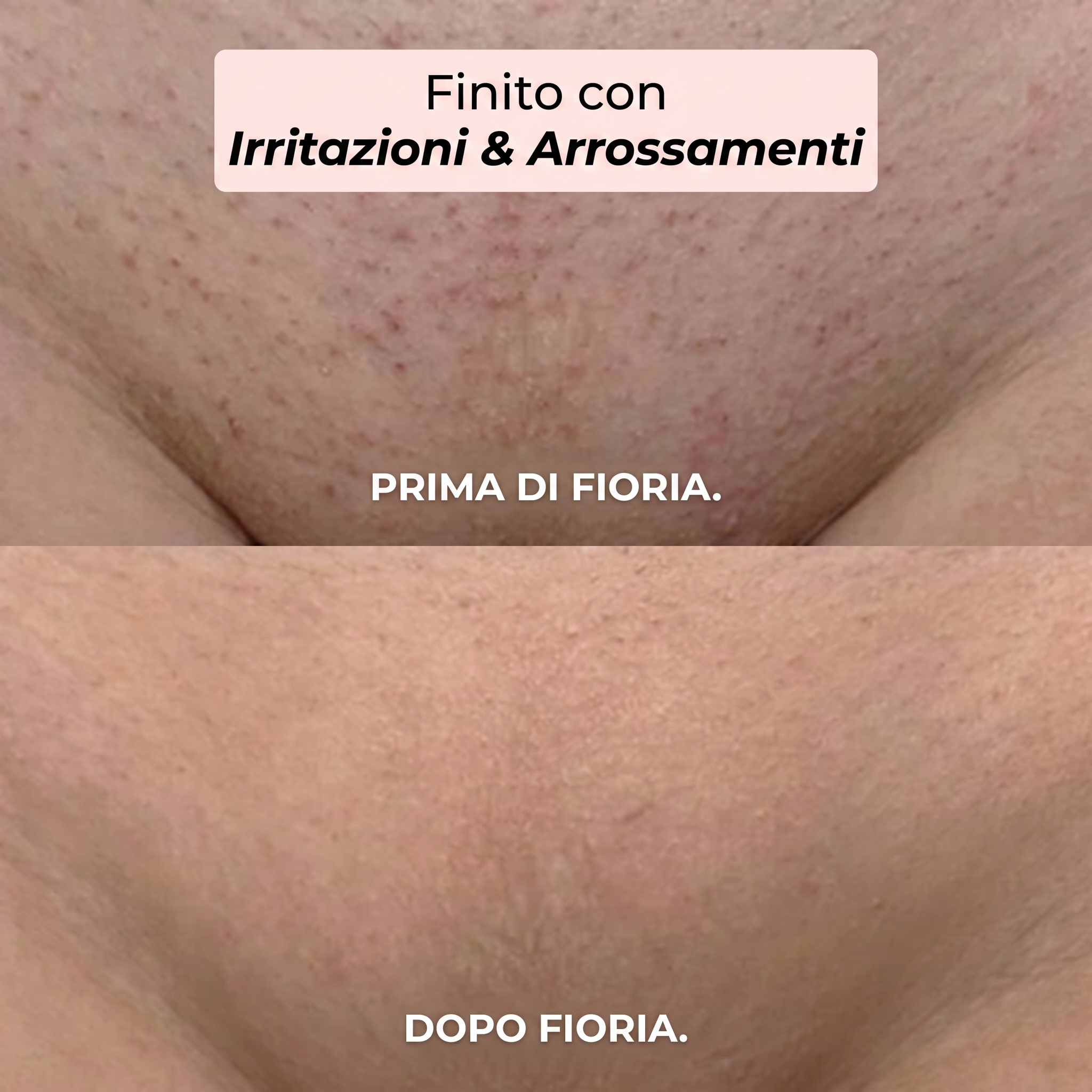 Rasoio 2 in 1 per Bikini e Corpo Fioria™